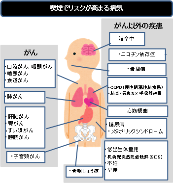 喫煙でリスクが高まるのは肺がんだけじゃない!!の画像